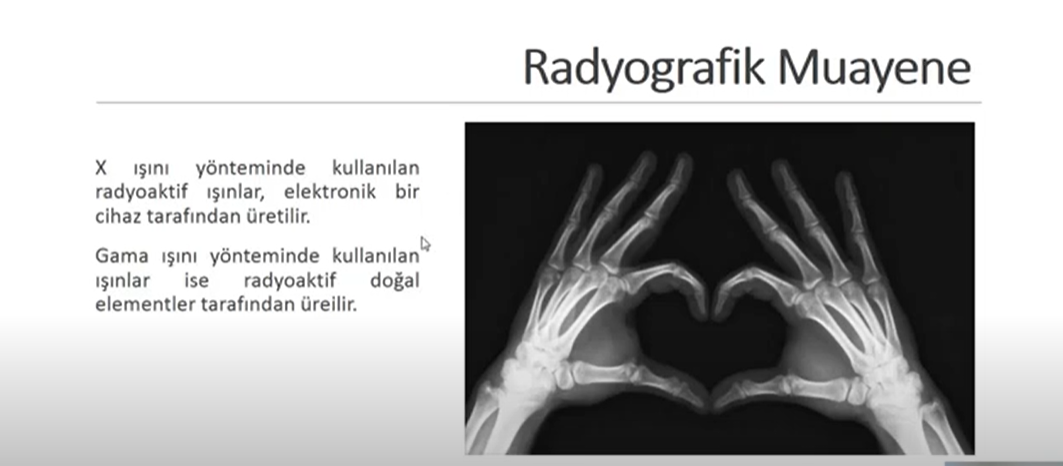 Radyografik Muayene